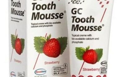 Benarkah Krim Tooth Mousse Dapat Melindungi Gigi Anak?