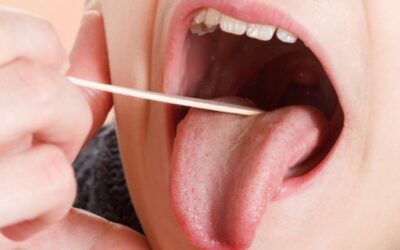 Gigi Goyang Akibat Diabetes? Bagaimana Mengatasinya?