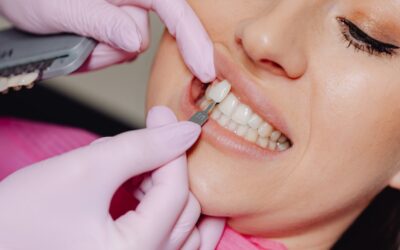 Veneer Gigi, Bahaya atau Tidak?