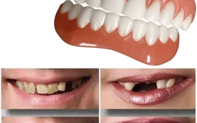 Apa Peran Gigi Tiruan?