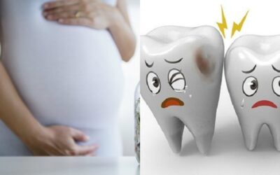 Sakit Gigi Saat Hamil, Apa Efeknya Untuk Janin?