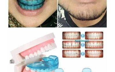 Apakah Alat Perapi Gigi Dari Toko Online Aman?