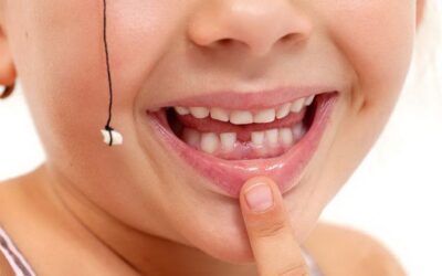 Cabut Gigi Anak Dengan Benang Aman atau Tidak?