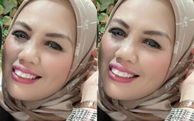 Wow! Ini Dia Bentuk Transformasi Elie Sugigi Yang Semakin Pede Dengan Gigi Rapinya