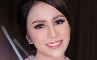 Cabut Gigi Gingsul, Ini Dia Deretan Artis Yang Tetap Cantik Dengan Gigi Rapinya!