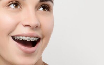 Stop! Jangan Coba-Coba Pakai Behel Abal-Abal Yaa!