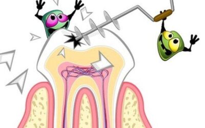 Apa Saja Sih Jenis Bakteri Yang Menyebabkan Gigi Berlubang?