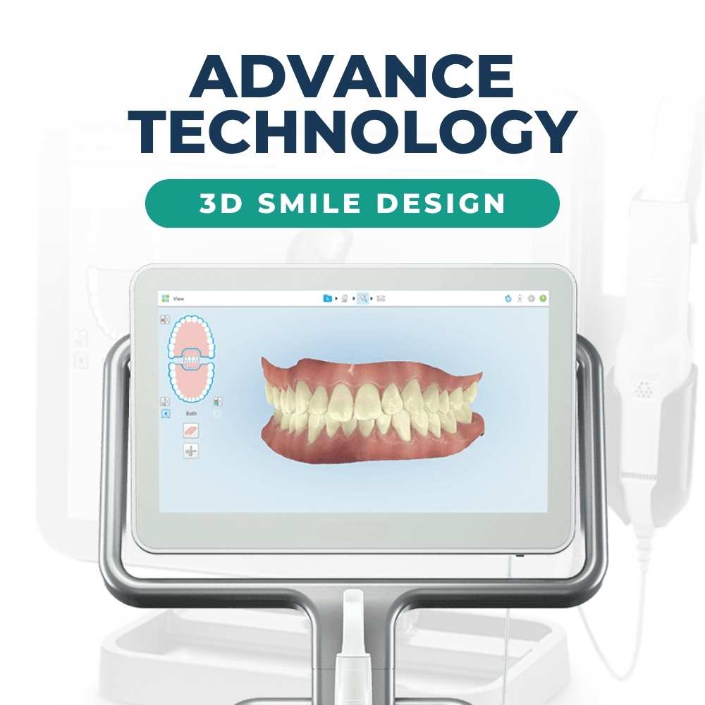  3D Smile Design 