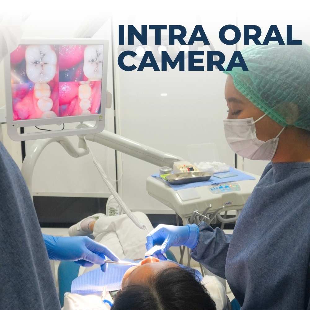  Intra Oral Camera (IOC) 